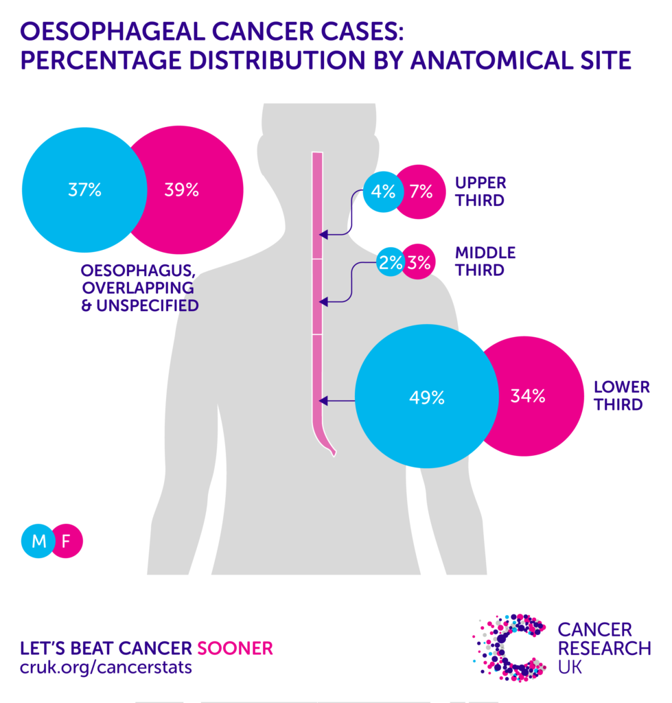 Cancer symptoms that nobody should ignore