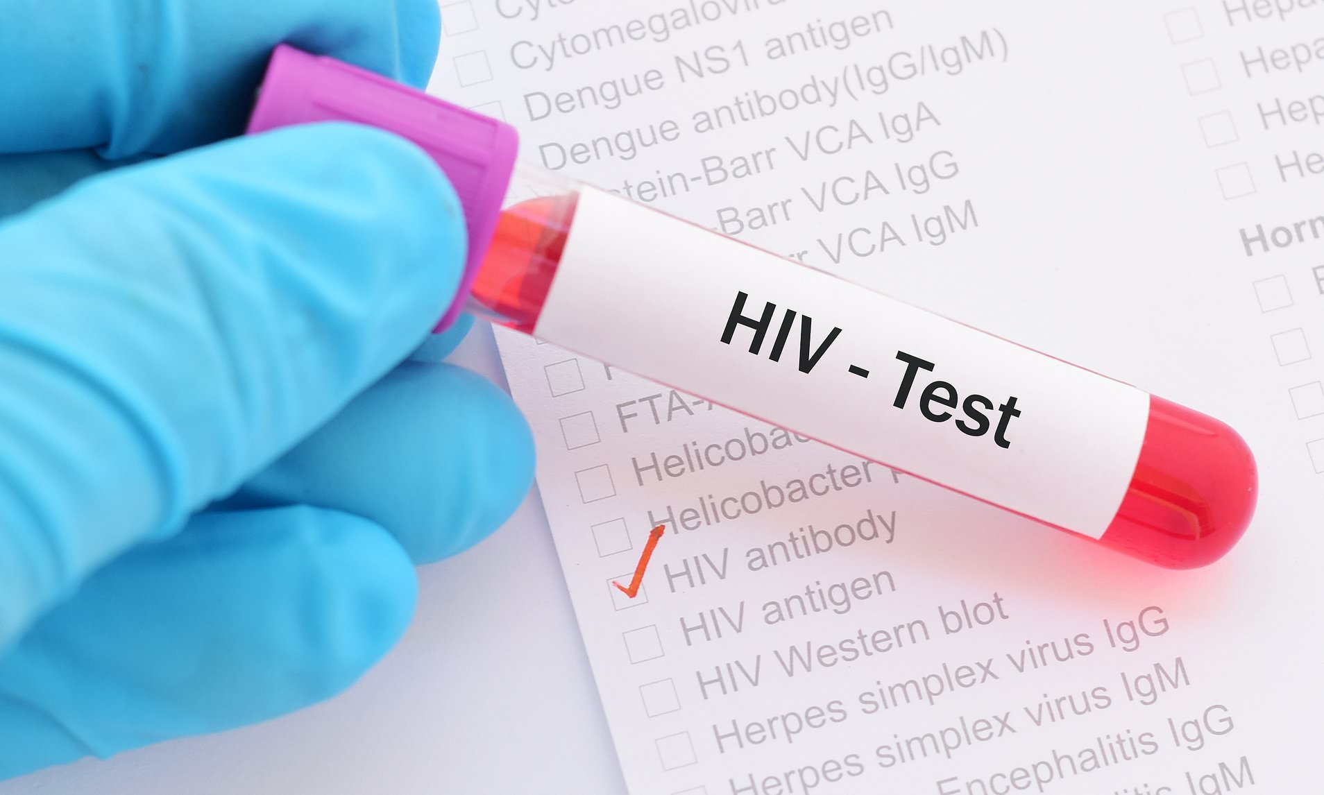 Cure For Hivaids Sex Based Treatment Will Work As Hiv Is Different In Men And Women