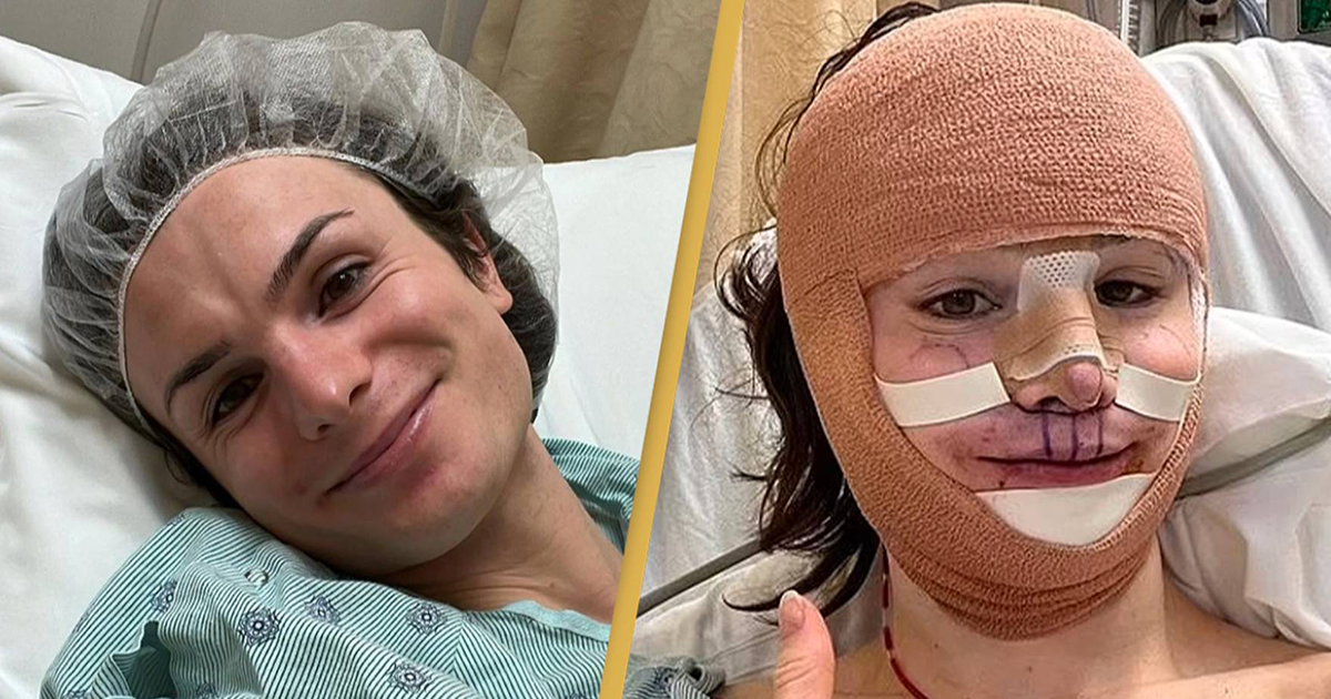 Dylan Mulvaney A Tiktok Influencer Shows Her Facial Feminization Surgery Results